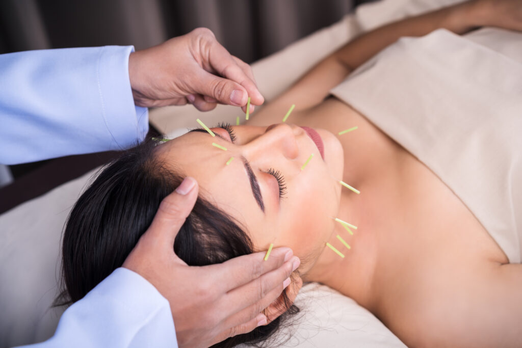 how facial acupuncture works