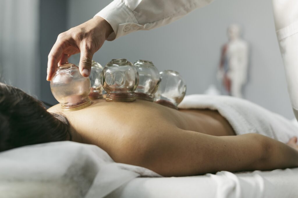 Cupping Traditional Chinese Medicine Techniques for Weight Loss