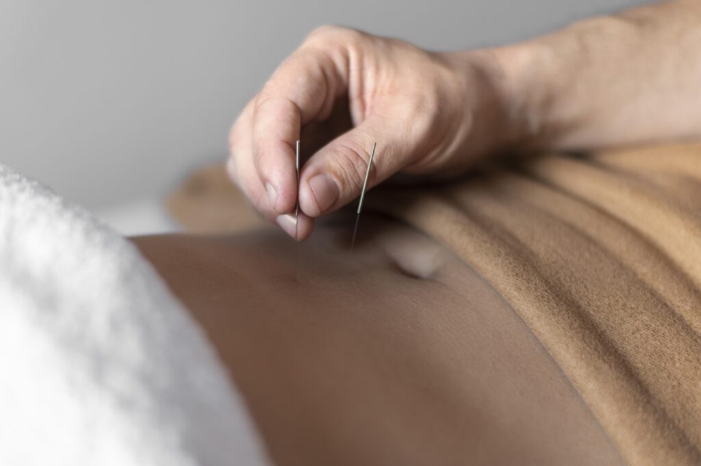 acupuncture treats stomach pain